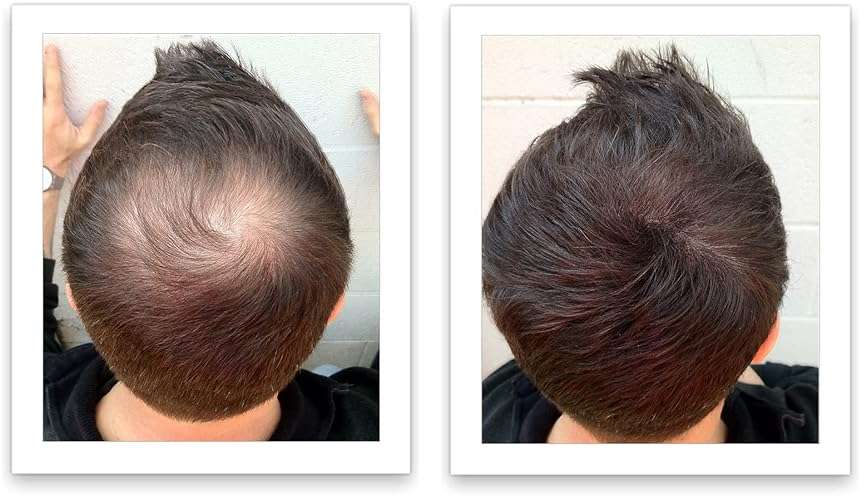 Caboki Hair Fibers for Thinning Hair – Natural Plant-Based Bald Spot Cover Up for Men and Women – Instantly Thicker Fuller Looking Scalp – Clean Ingredients – Trial Size, 10-Day Supply, Dark Brown - Image 8