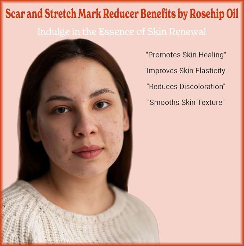 SALE! 4oz Rosehip Seed Oil, 100% Pure and Natural, Cold-Pressed, Unrefined, Organic Moisturizer for Skin and Hair - Includes Pump & Dropper - Image 9
