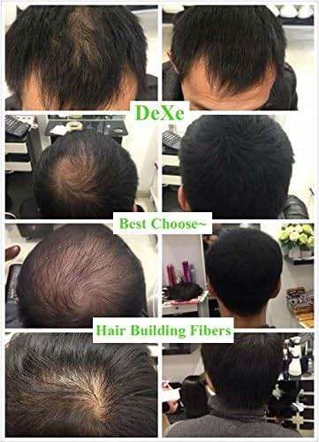 Black Colored Hair Building Fibers - Thickening Fiber for Women and Men - Hair Loss Concealer Powder for Thicker Fuller Hair - .77oz - Image 7
