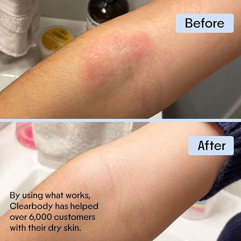 Clearbody Organics Manuka Honey Gel Cream (2 fl oz) - Lighter Eczema Cream with Colloidal Oatmeal - Moisturizing, Soothing and Anti Itch Lotion for Dry Skin - Image 6