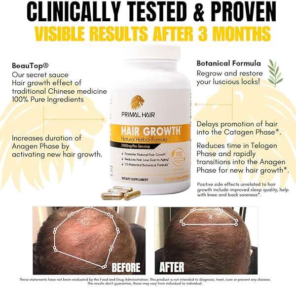 Primal Hair Natural Hair Growth Supplement for Men & Women - US Patented Botanical Formula for Thicker Fuller Hair - Anti-Hair Loss & Scalp Wellness - 100% Vegan, Non-GMO - 120ct (30-Day Supply) - Image 4