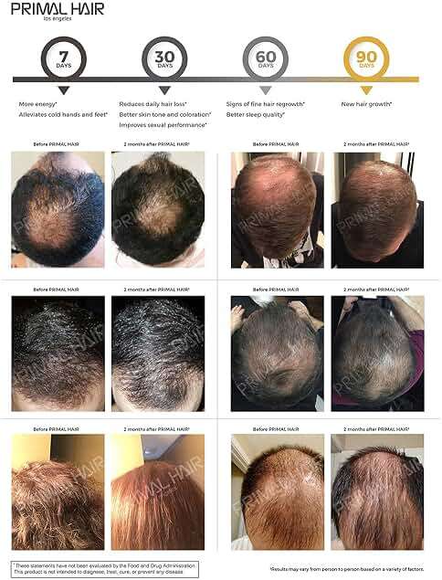 Primal Hair Natural Hair Growth Supplement for Men & Women - US Patented Botanical Formula for Thicker Fuller Hair - Anti-Hair Loss & Scalp Wellness - 100% Vegan, Non-GMO - 120ct (30-Day Supply) - Image 6