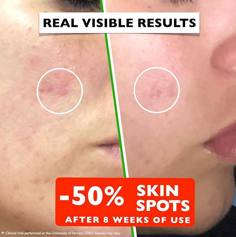 Vitamin C Serum For Face – Anti Aging Face Serum with Vitamin C, Hyaluronic Acid, Vitamin E. Brightening Formula. Improve Appearance of Dark Spots, Tone, Fine Lines & Wrinkles, Glowing Skin 2 Fl Oz - Image 4