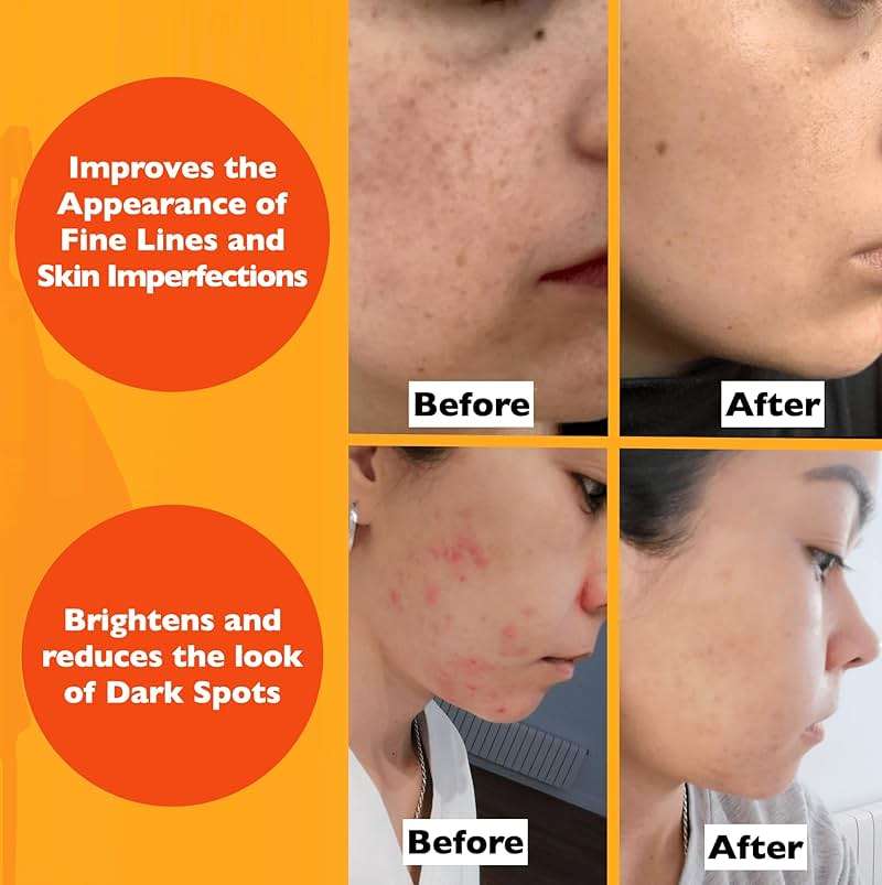 Vitamin C Serum For Face – Anti Aging Face Serum with Vitamin C, Hyaluronic Acid, Vitamin E. Brightening Formula. Improve Appearance of Dark Spots, Tone, Fine Lines & Wrinkles, Glowing Skin 2 Fl Oz - Image 5