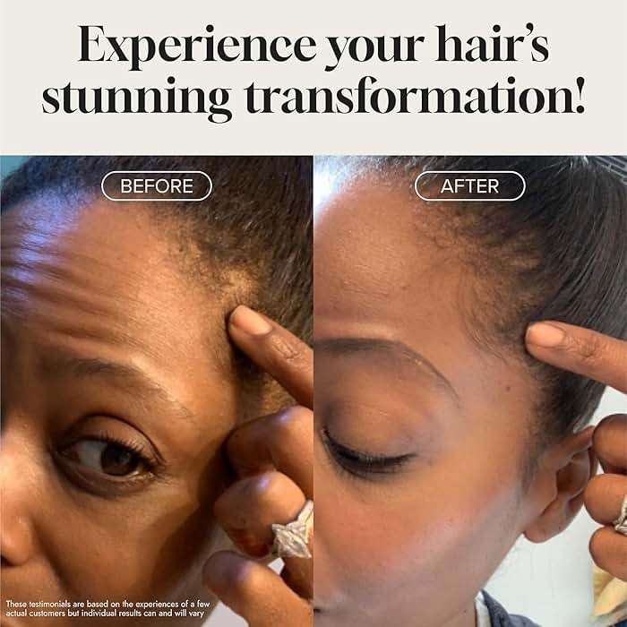Biotin Hair Growth Serum Advanced Topical Formula To Help Grow Healthy, Strong Hair Suitable for Men and Women of All Hair Types Hair Loss Support By Pureauty Naturals 2 Fl Oz (Pack of 1) - Image 4