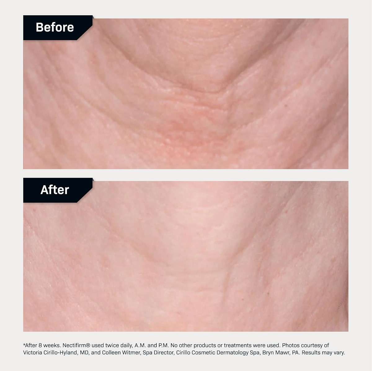 Revision Skincare Nectifirm® Neck Cream – Clinically Proven to Firm, Lift & Smooth the Neck and Jawline, Brightening Skin and Reducing Early Signs of Aging - Image 6
