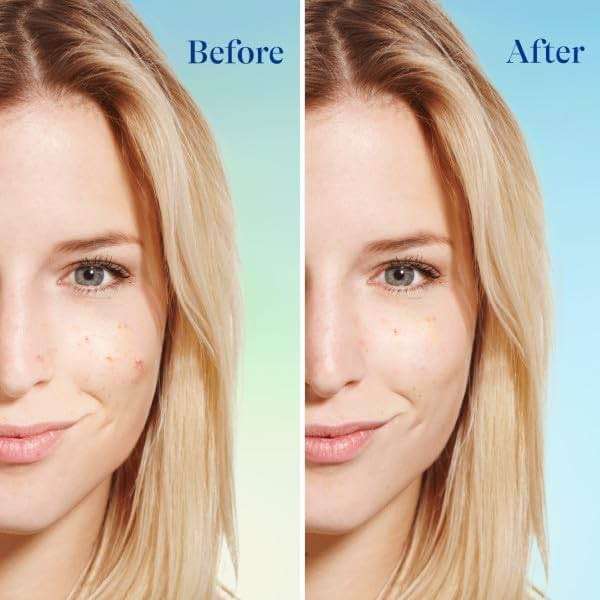 Differin Acne Face Wash with 5% Benzoyl Peroxide, Daily Deep Cleanser by the makers of Differin Gel, Gentle Skin Care for Acne Prone Sensitive Skin, 4 oz (Packaging May Vary) - Image 8