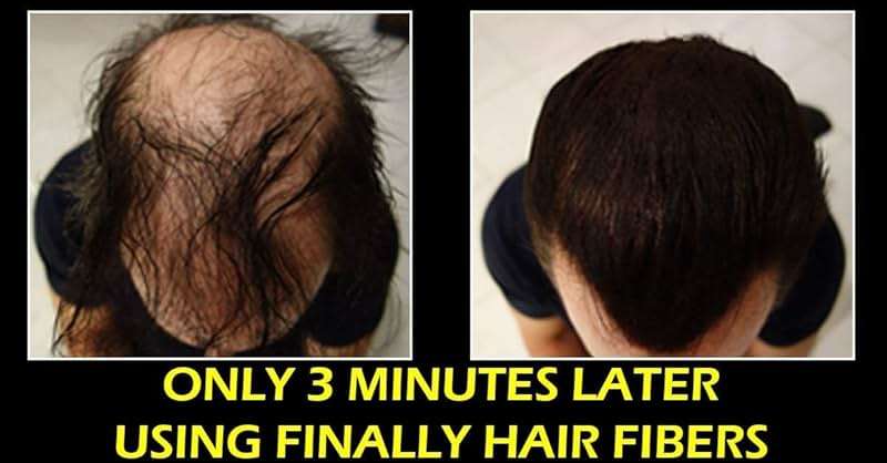 Finally Hair Fiber Lock Strong Holding Spray. Compatible/Replacement For Toppik, Xfusion, Febron, Bosley, Nanogen - Image 4