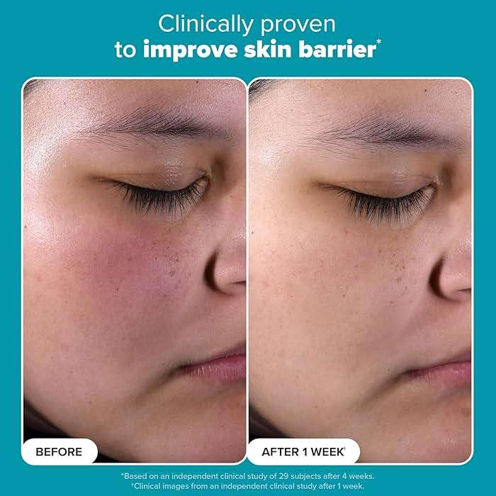 Paula's Choice SKIN PERFECTING 2% BHA Liquid Exfoliant with Salicylic Acid, Facial Polish for Pores, Wrinkles & Fine Lines, Suitable for Blackhead-Prone Skin, Fragrance-Free - Image 3