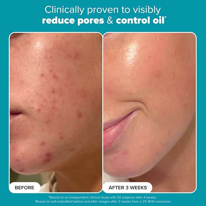 Paula's Choice SKIN PERFECTING 2% BHA Liquid Exfoliant with Salicylic Acid, Facial Polish for Pores, Wrinkles & Fine Lines, Suitable for Blackhead-Prone Skin, Fragrance-Free - Image 4