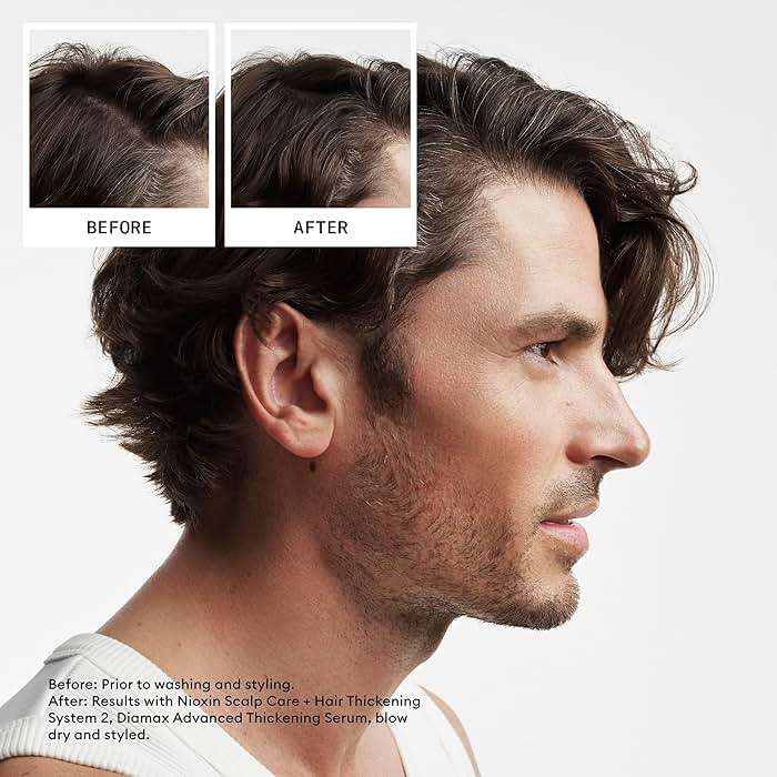 NIOXIN System 2 Scalp + Hair Thickening Conditioner for Natural Hair with Progressed Thinning | Boost Hair Density with Niacinamide & Biotin | Refreshed Scalp with Healthy Shine - Image 3