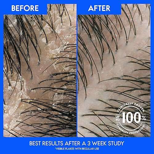 Head & Shoulders Anti-Dandruff Shampoo and Conditioner, Full and Thick 2-in-1 Twin Pack, 1% Pyrithione Zinc, Cleans to Restore Fullness to Thinning Hair, 32.1 fl oz Each - Image 5