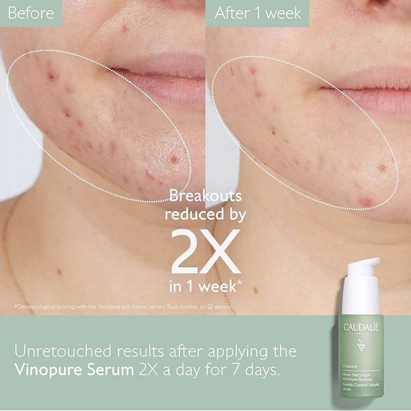 Caudalie Vinopure Natural Salicylic Acid Pore Minimizing Serum with Niacinamide, Skin Perfecting Serum - 30 mL - Image 4