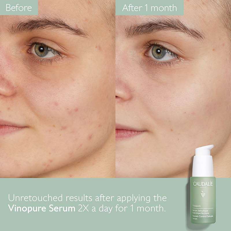 Caudalie Vinopure Natural Salicylic Acid Pore Minimizing Serum with Niacinamide, Skin Perfecting Serum - 30 mL - Image 6