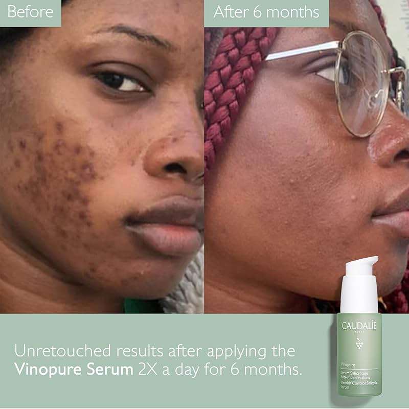 Caudalie Vinopure Natural Salicylic Acid Pore Minimizing Serum with Niacinamide, Skin Perfecting Serum - 30 mL - Image 9