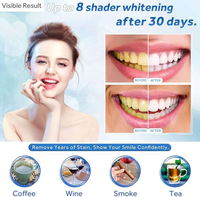 EZGO 10 Pack Teeth Whitening Gel Refills 22% Bleaching Gel, No Sensitive Teeth Whitener, Great for Sensitive Tooth Whitening, Carbamide Peroxide Teeth Whitening Gel, Mint Flavor (10X 3ML) - Image 2