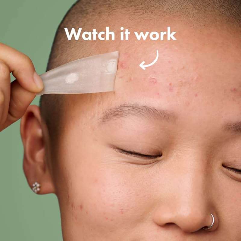 Mighty Patch Surface Large Pimple Patches for Face, Acne Spot Patch for Cheek, Forehead, and Chin, Pimple Stickers, Hydrocolloid Covers, Vegan-friendly, from Hero Cosmetics, 10 Count - Image 4