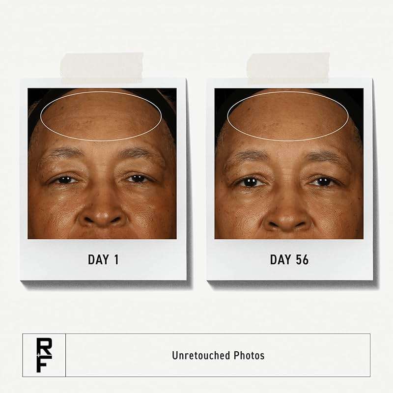 RODAN + FIELDS Redefine Daily Face Clay Cleanser (125 mL) | Advanced Skin Care | Exfoliating Face Wash & Face Mask for Sensitive Skin | Anti-Aging Face Cleanser for Women and Men - Image 2