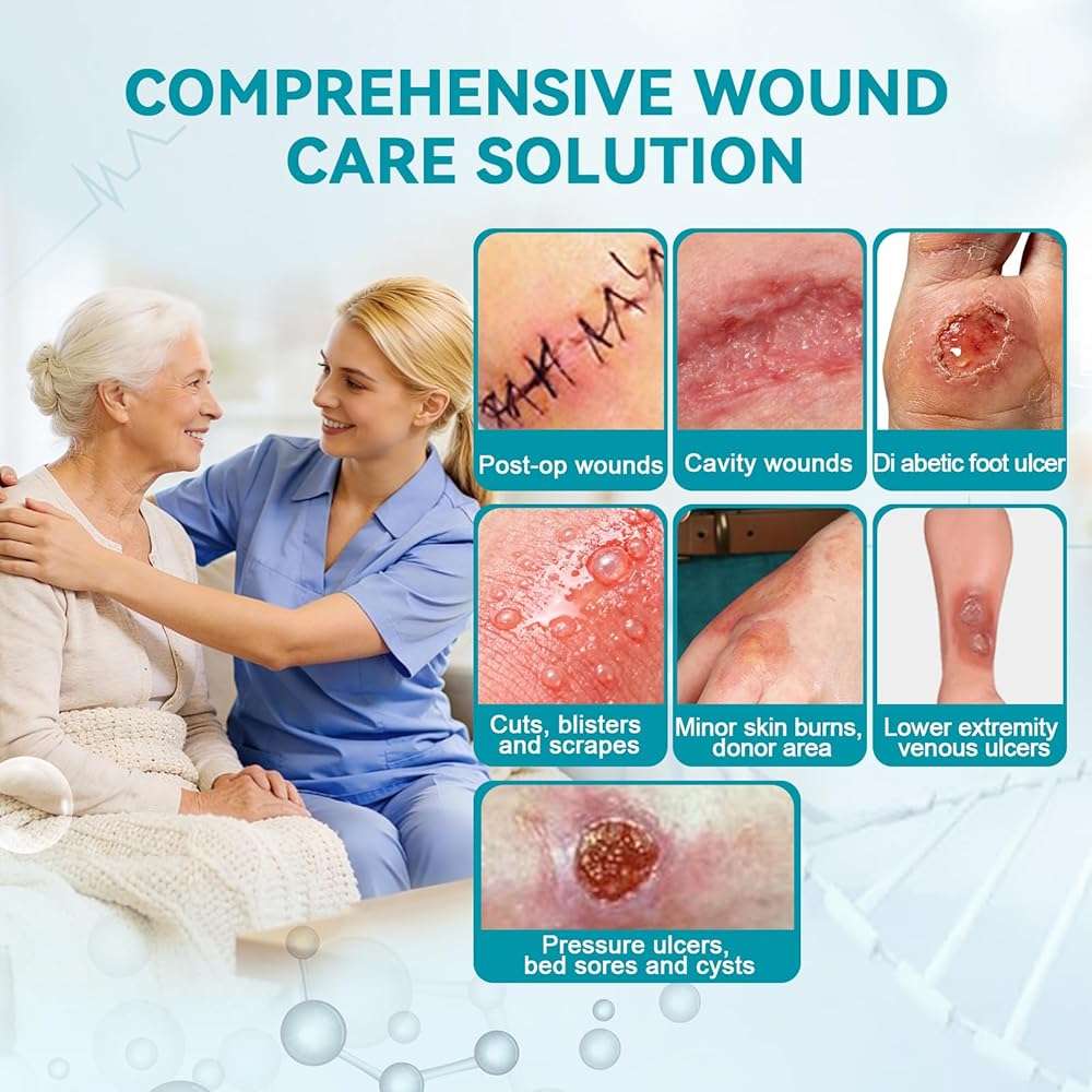 Dimora Calcium Alginate Wound Dressing, 4'' x 4'' Patches,10 Individual Sterile Pads, Soft and Highly Absorbent Dressing Gauze, Non-Stick Padding - Image 2
