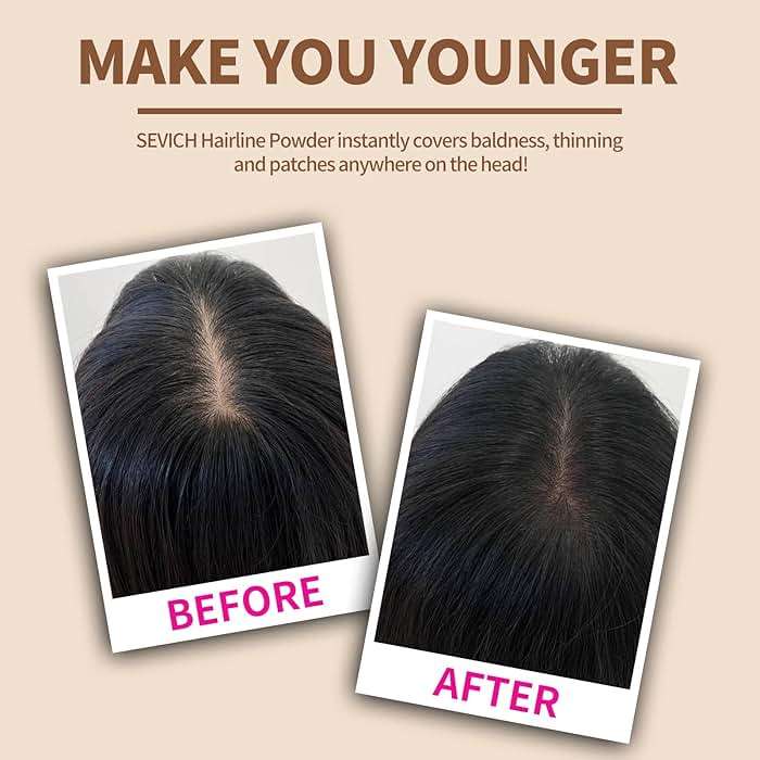 Sevich Hairline Powder,Instantly Conceals Hair Loss, Root Touch up Powder, Hair Shadow Toppers for Women & Men, Touch Up for Thinning Gray Hair, Windproof & Sweatproof,Medium brown - Image 2