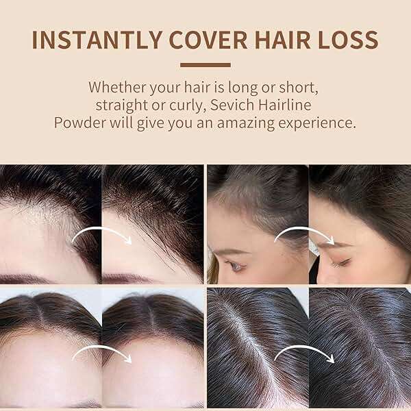 Sevich Hairline Powder,Instantly Conceals Hair Loss, Root Touch up Powder, Hair Shadow Toppers for Women & Men, Touch Up for Thinning Gray Hair, Windproof & Sweatproof,Medium brown - Image 4
