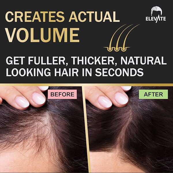 ELEVATE Hair Fibers to Instantly Thicken & Completely Conceal Thinning Balding Areas Loss in 30 Seconds for Men & Women (DARK BROWN) 28g Size - 100% Natural & Undetectable Keratin Fibers - Image 8