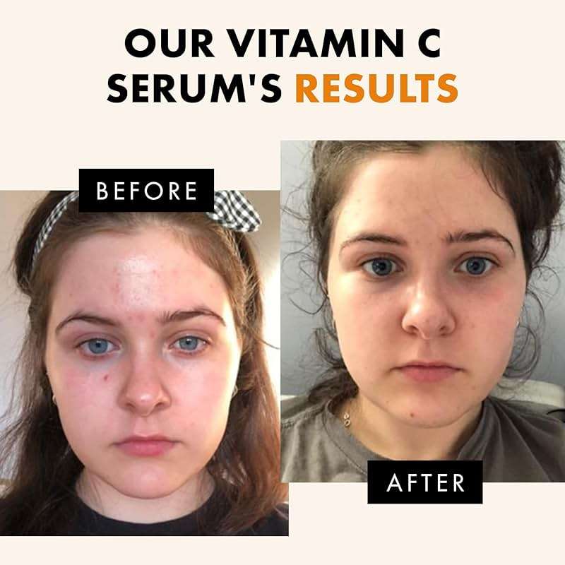 Eclat Skincare Vitamin C Serum - Skin Care for Dark Spots, Vitamin C Serum for Face with Hyaluronic Acid, Ferulic Acid, & Vit E - Anti Aging and Skin Brightening Vit C Formula for Face Care 1 Fl Oz - Image 3
