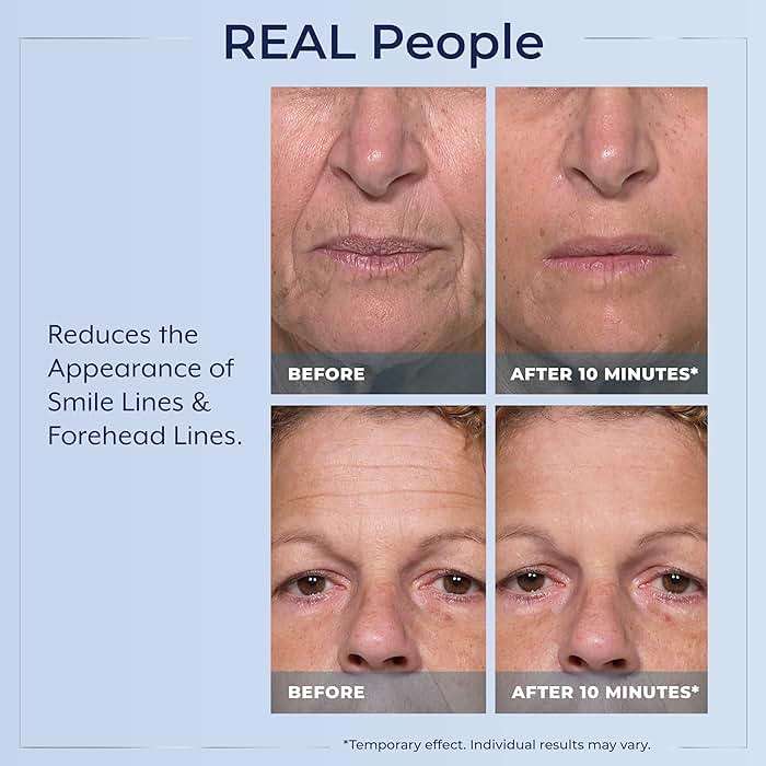 Plexaderm Rapid Reduction Eye Serum - Visibly Reduces Under-Eye Bags, Wrinkles, Dark Circles, Fine Lines & Crow's Feet Instantly, Anti Aging Wrinkle Remover for Face, Pump - Image 4