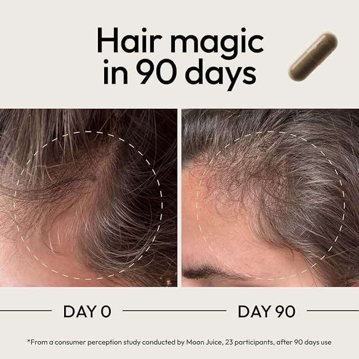 Moon Juice SuperHair Hair Growth Vitamins for Women & Men with Biotin & Saw Palmetto - Clinical Strength Multivitamin Hair Supplement for Healthier, Stronger, Thicker Hair, 120 Capsules - 30 Servings - Image 4