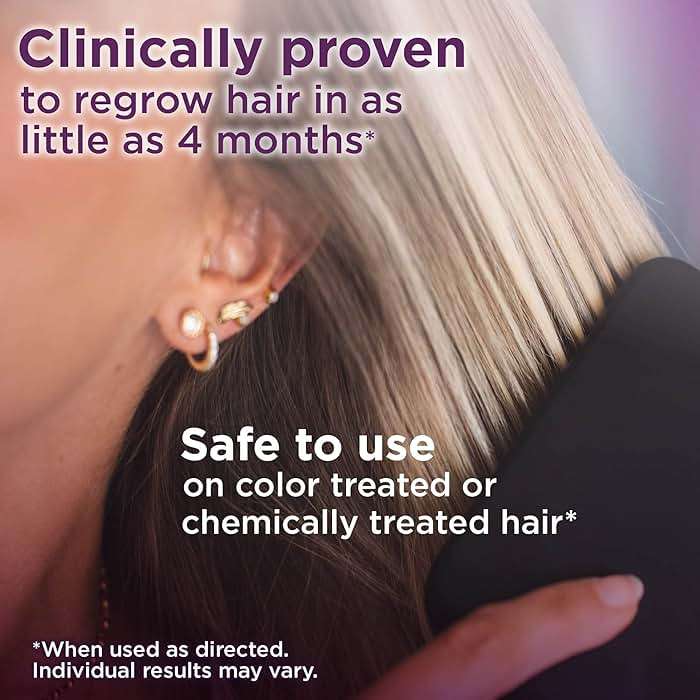 Amazon Basic Care Minoxidil Topical Solution, 2 Percent, Hair Regrowth Treatment For Women, 6 Ounce - Image 2