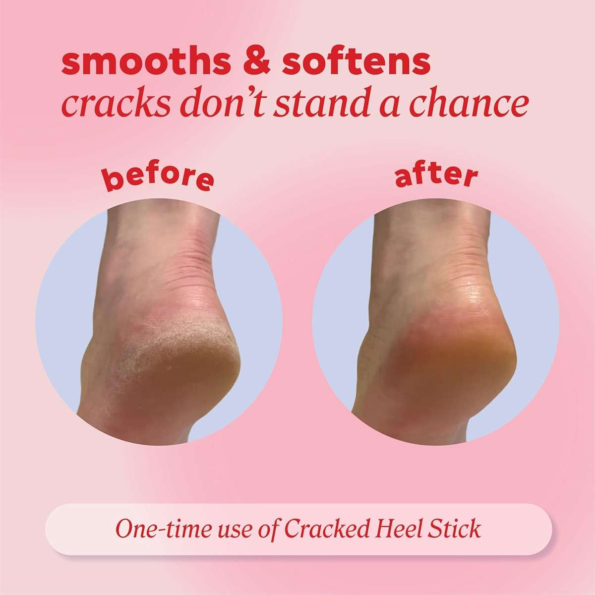 Onyx Professional Cracked Heel Repair Balm Stick for Dry Cracked Feet Treatment, Coconut Scent, 1 pack - Moisturizing Foot Balm, Rolls On, Cracked Heel Treatment - Image 4
