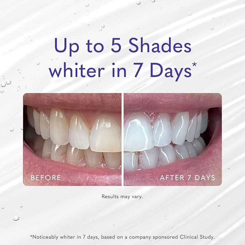Smileactives Teeth Whitening Gel, Clinical-Grade Hydrogen Peroxide for Long Lasting White Teeth – Simply Add to Toothpaste to Permanently Remove Coffee Stains & More, 2 oz - Image 4