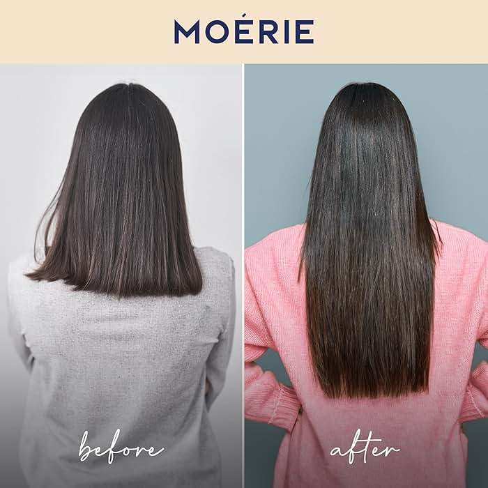 Moerie Hair Growth Shampoo and Conditioner for Women and Men, Hair Loss Solution with Biotin and Rosemary, Thickening Shampoo and Conditioner for Thinning Hair – Promotes Regrowth - Image 6