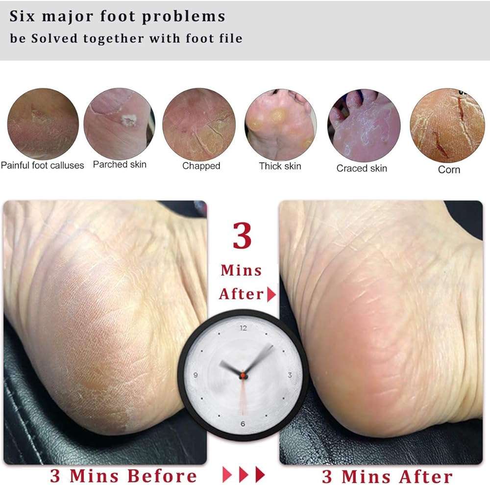 Kinepi Foot File & Foot Scrubber,Pumice Stone for Feet Callus Remover | Pedicure foot rasp helps smooth cracked heels,dead skin,and hard skin after shower for wet or dry daily and weekly foot care - Image 3