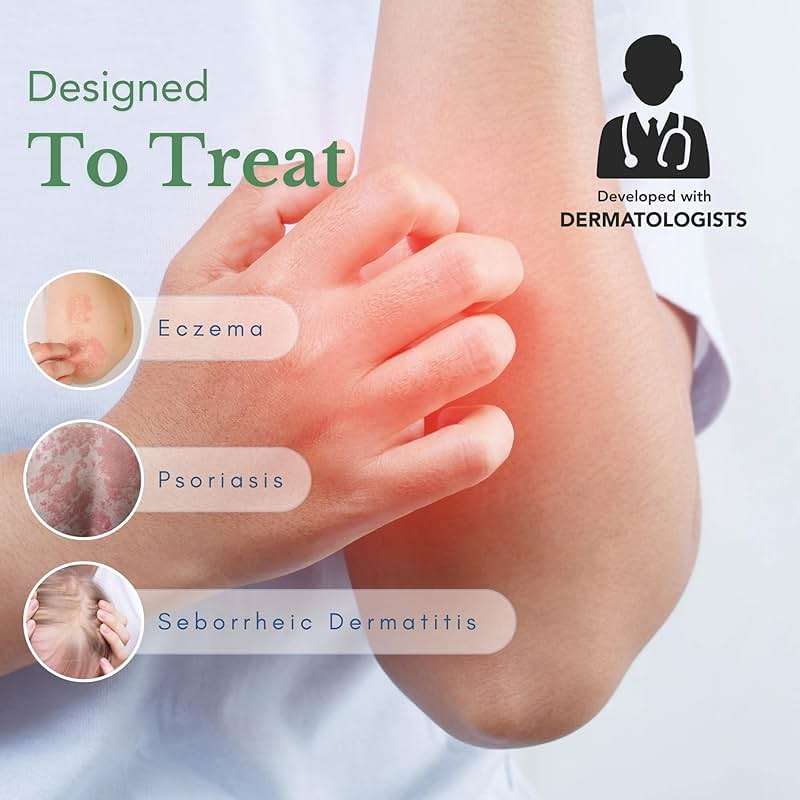 Theraplex AIM - Anti-Itch Moisturizing Cream (3 oz) - Non-stinging, Relieves Itching, Rashes, Flare Ups - Helps Repair & Restore the Skin's Natural Protective Barrier - Image 2