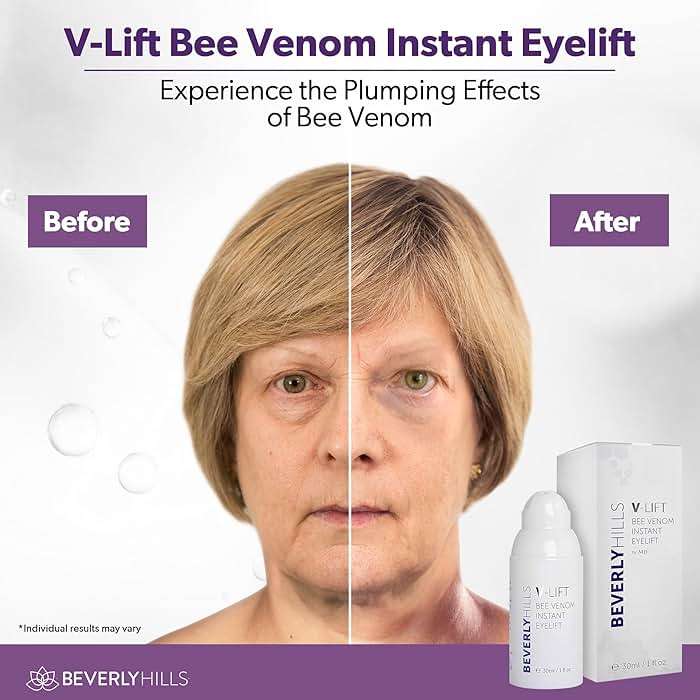 Beverly Hills V-Lift Instant Eye Lift and Eye Tuck Bee Venom Serum for Puffy Eyes, Dark Circles, Wrinkles, and Under Eye Bags Treatment for Women and Men | 30mL (120 Day Supply) - Image 3