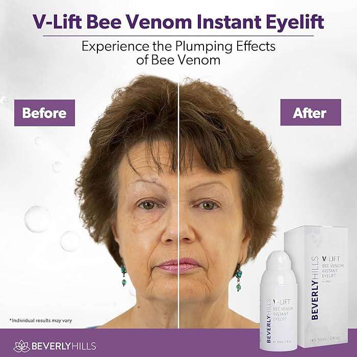 Beverly Hills V-Lift Instant Eye Lift and Eye Tuck Bee Venom Serum for Puffy Eyes, Dark Circles, Wrinkles, and Under Eye Bags Treatment for Women and Men | 30mL (120 Day Supply) - Image 5