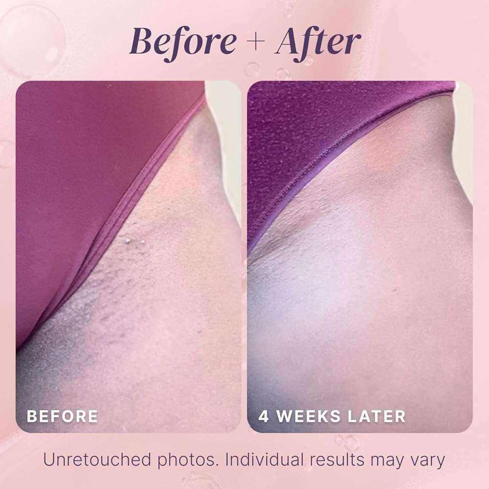 Razor Bump Stopper with Dark Spot Remover, Ingrown Hair Treatment for Bikini Area and Razor Bumps Treatment - Salicylic Acid After Shave Solution for Ingrown Hairs & Razor Burns - Image 8