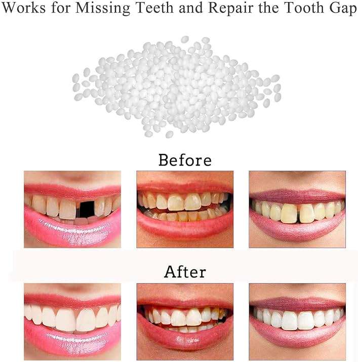 Tooth Repair Kit-Thermal Beads for Filling Fix The Missing and Broken Tooth or Adhesive The Denture Fake Teeth - Image 2