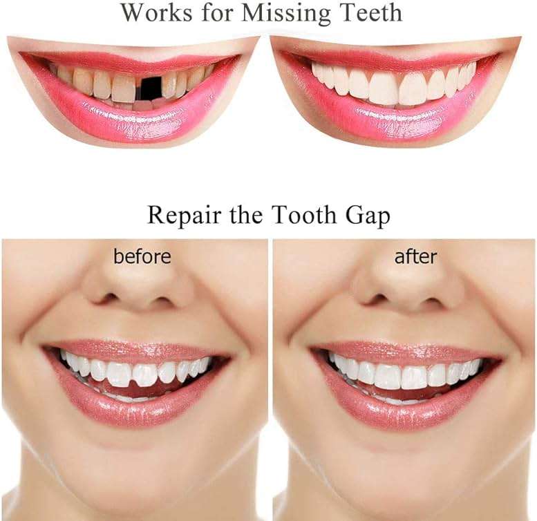 Tooth Repair Kit-Thermal Beads for Filling Fix The Missing and Broken Tooth or Adhesive The Denture Fake Teeth - Image 3