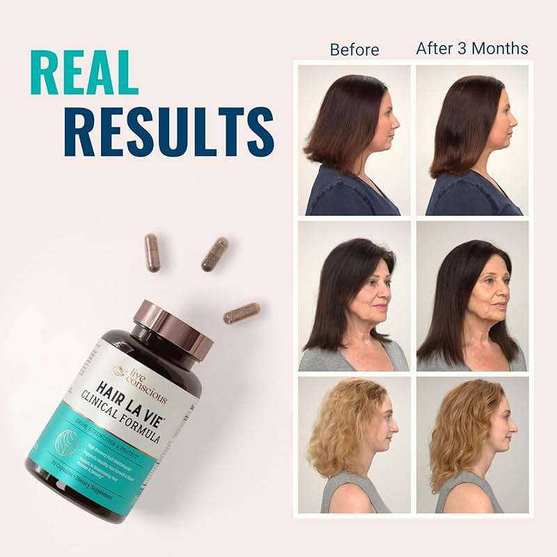 Hair La Vie Live Conscious Clinical Formula Hair Growth Vitamins for Women and Men w/Biotin, Collagen & Saw Palmetto (Pack of 1) - Image 3