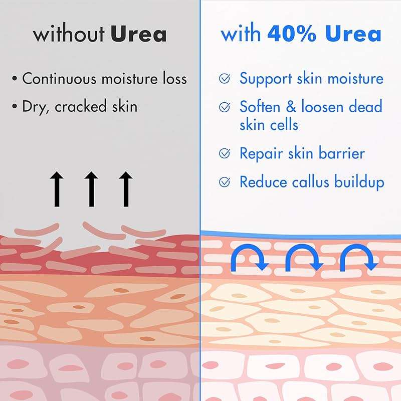 Ebanel Urea Cream 40% plus Salicylic Acid 2%, Foot Cream for Dry Cracked Heels Feet Knees Elbows Hands, Foot Dead Skin Cuticle Callus Remover Toenail Softener, Keratolytic Skin Barrier Repair - Image 5