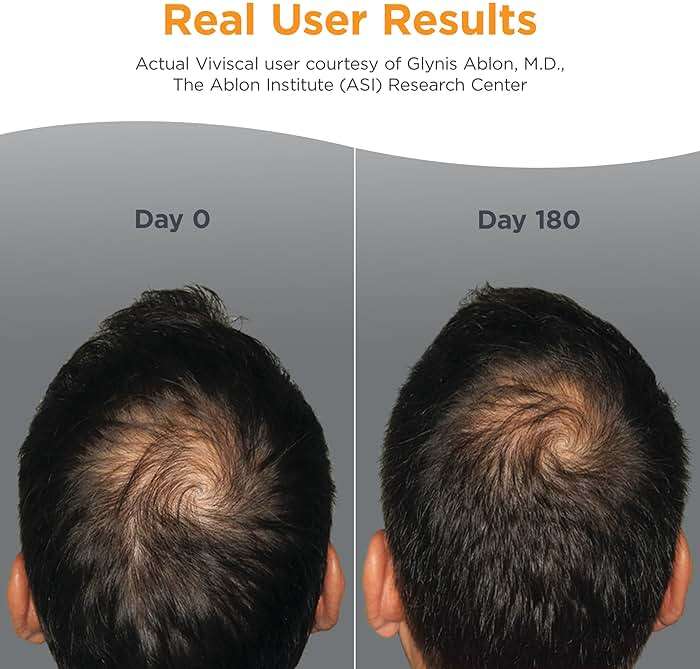 Viviscal Men's Hair Growth Supplements for Thicker Fuller Hair, Clinically Proven Collagen Complex, 180 Tablets 3 Month Supply - Image 3