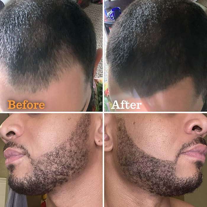 Beard Pen Filler for Men - Barber Styling Grooming Pencil, Waterproof & Sweat Proof, Long Lasting, Natural Finish, Cover Beard & Scalp Patches - Black, 1 Pack - Image 2