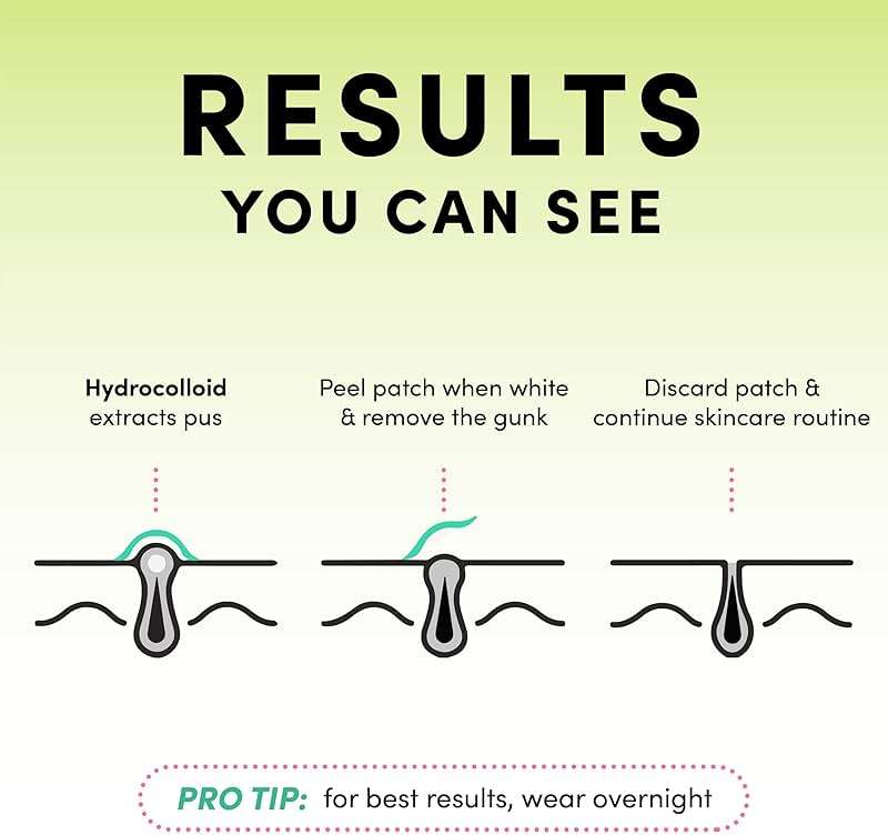 Dots for Spots Pimple Patches For Face - Fast Acting, Translucent Hydrocolloid Zit Patches that Unclog Pores Korean Skin Care - Vegan, Cruelty Free - (60 count) - Image 3