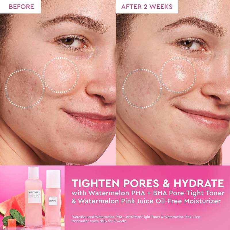 Glow Recipe PHA + BHA Face Toner, Korean Exfoliating Toner for Pores, Gentle Chemical Exfoliant + Hydrating Toner, Watermelon, Cactus Water + Glycerin (150ml) - Image 3