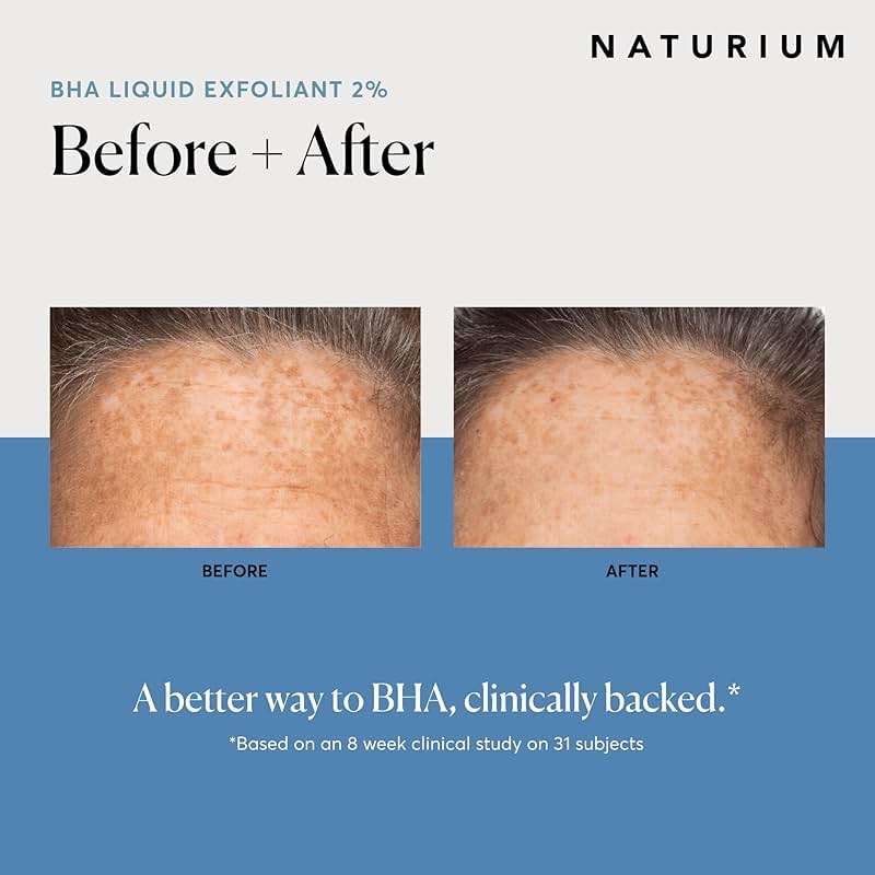 Naturium BHA Liquid Exfoliant 2%, Leave-on Face & Skin Care Exfoliating Pore Treatment, with Salicylic Acid & Bioactive Fruit Acids, Packaging May Vary, 4 oz - Image 4