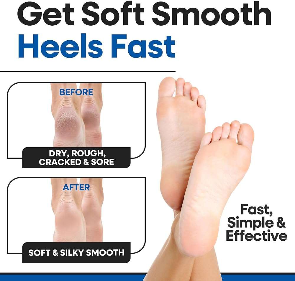 Moisturizing Socks for Men | Cracked Heel Treatment with Aloe Vera | Moisturizer Foot Callus Remover | Aloe Socks for Cracked Heels & Dry Cracked Feet | Lotion Infused Gel Heel Socks (XL - 3 Pairs) - Image 5