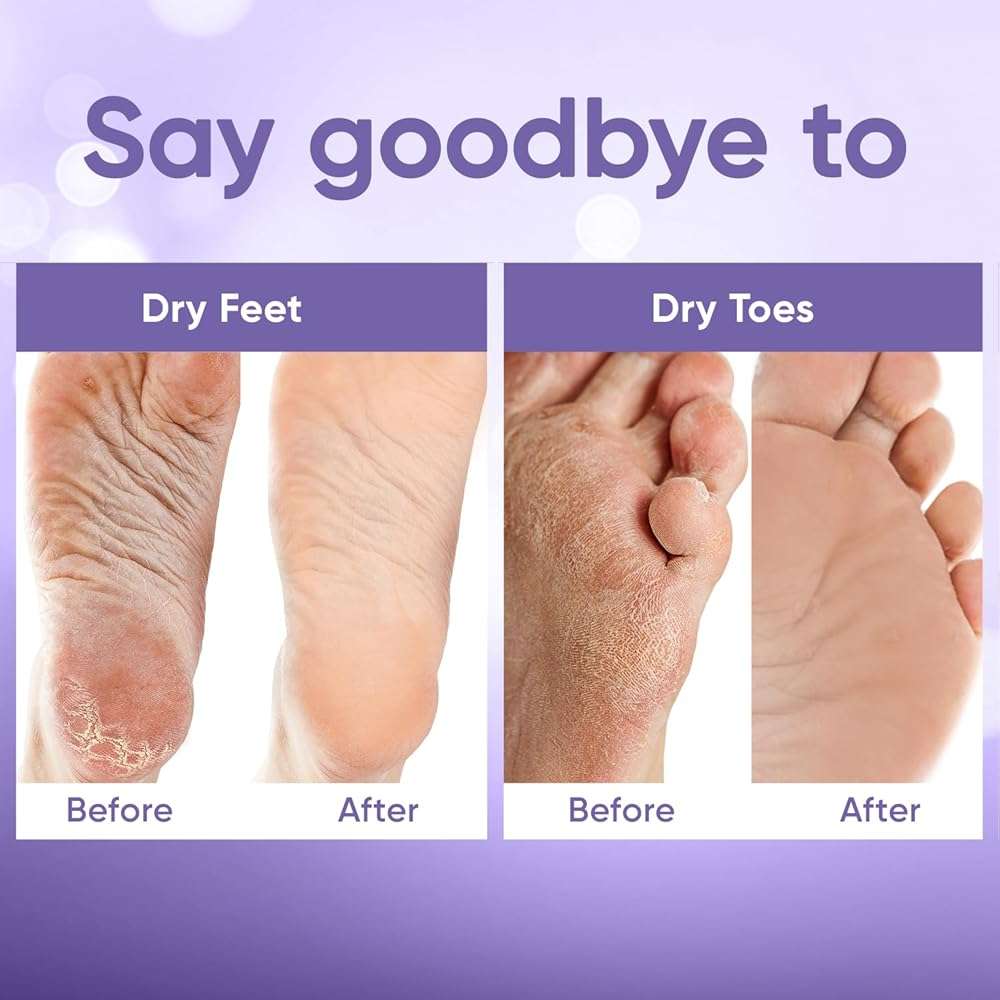 CÉLOR Foot Peeling Mask for Dry Cracked Feet | Foot Mask to Exfoliate Rough, Cracked, Dry Feet, Calluses for Soft Baby Feet Results | Made with Aloe Vera Extract for Women & Men (2 Pairs) | Lavender - Image 5