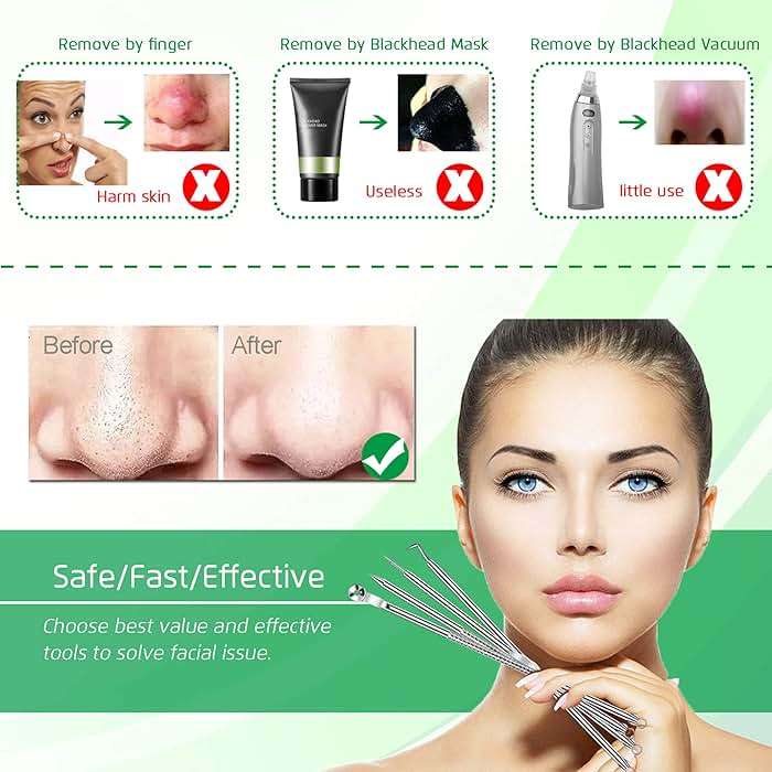 5PCS Blackhead Remover Comedone Extractor, Curved Blackhead Tweezers Kit, Professional Stainless Pimple Acne Blemish Removal Tools Kit for Manual - Image 2